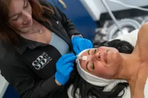 Chemical Peel Service in haslett mi | Skin Boss Med Spa