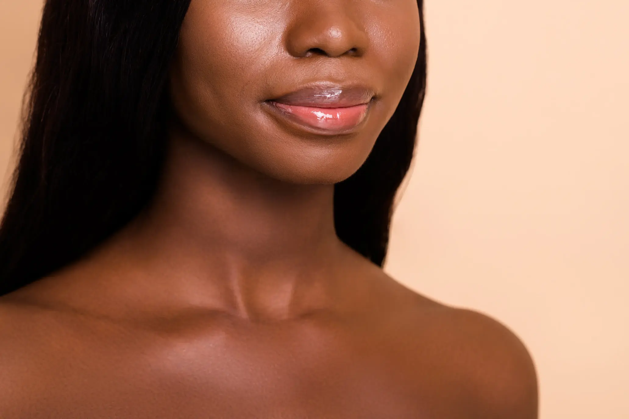 A woman received the Dermal Fillers Treatment At Skin Boss Med spa